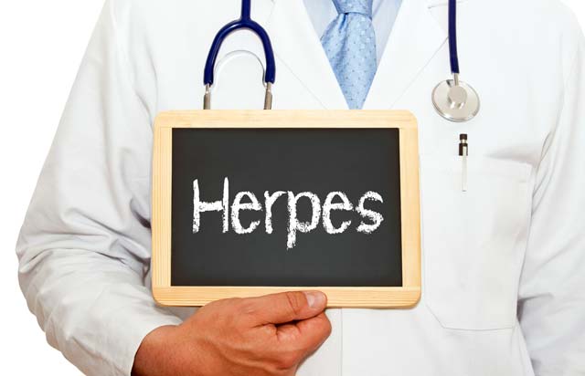 Médico segurando placa com a palavra "Herpes"